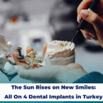 The Sun Rises on New Smiles: All On 4 Dental Implants in Turkey